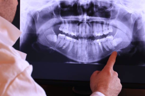 Best Broken or Cracked Tooth Emergency Dentist in West, TX